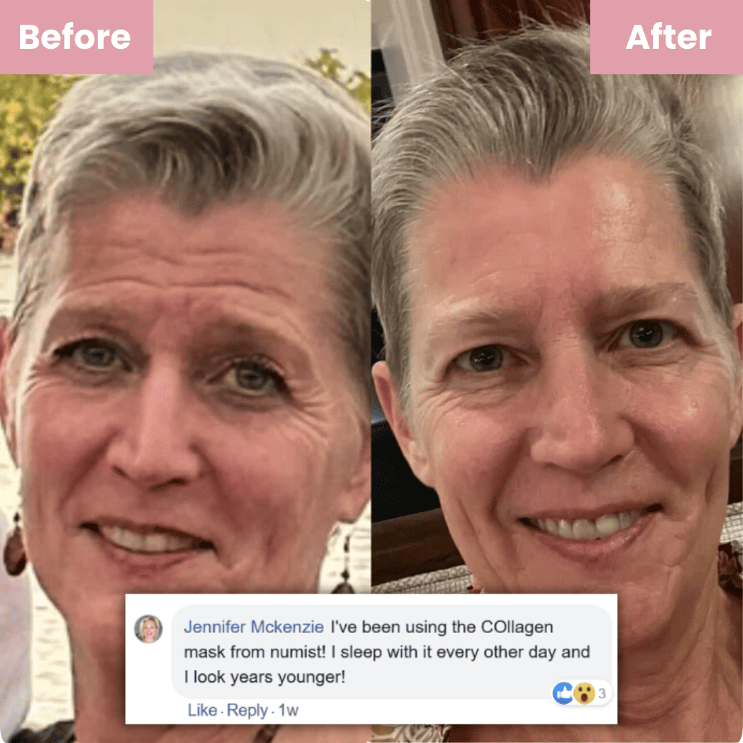 Lasinen kollageeninaamio